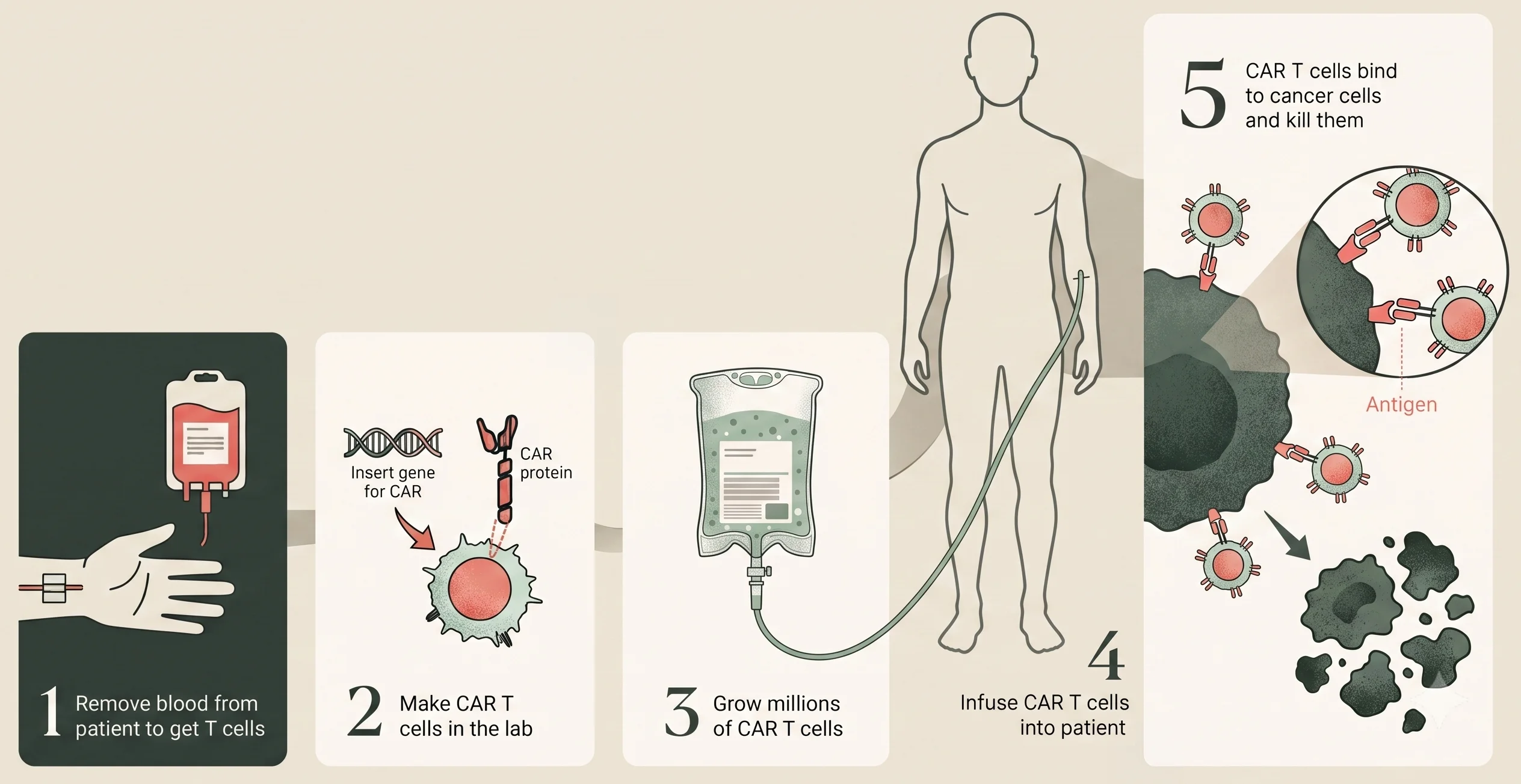 Diagram of the CAR T-cell process: blood is drawn, T-cells are re-engineered in the lab to express a CAR protein, grown in number, infused into the patient, and the CAR T-cells bind to and destroy cancer cells.